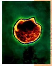The spherical-shaped Chlamydia pneumonia bacteria.