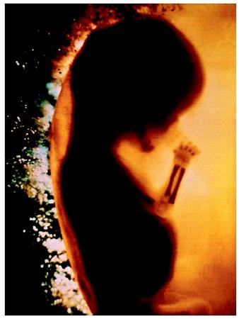 A human fetus at ten weeks.
