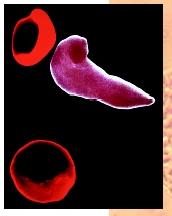 A scanning electron micrograph showing healthy, round red blood cells and a diseased sickle-shaped cell.