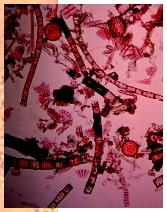 Diatoms, unicellular algae encased in siliceous walls, often display delicate lacy designs.