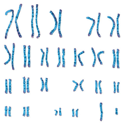 Chromosome Aberrations 3839