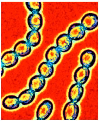 A colored transmission electron micrograph of Streptococcus pyogenes bacteria.