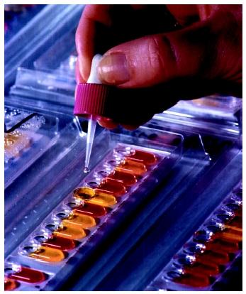 A laboratory technician performing an Analytical Profile Index (API) test on bacteria.