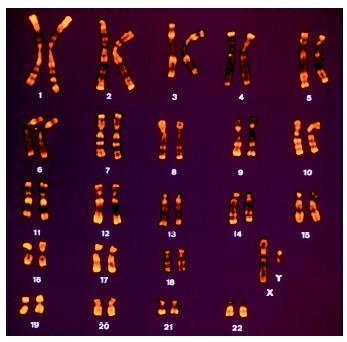 A karyotype of human male chromosomes (XY karyotype) with G banding.