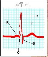 Electrical activity of the heart is recorded in an electrocardiogram. Here, one complete cycle is shown, comprising contraction and relaxation of the atria and the ventricles.