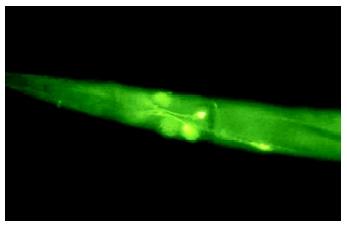 Recombinant DNA technology helps highlight the brain of C. elegans. To photograph its brain, a fluorescent protein was linked to the fax-1 protein in the brain; the glowing neurons reveal the cells in which fax-1 functions.